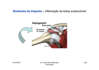 14/12/2015 Dr. José Heitor Machado
Fernandes
235
Síndrome do Impacto – inflamação da bolsa subacromial
 