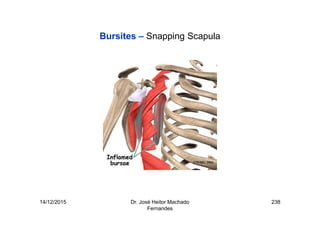 14/12/2015 Dr. José Heitor Machado
Fernandes
238
Bursites – Snapping Scapula
 