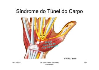 14/12/2015 Dr. José Heitor Machado
Fernandes
251
Síndrome do Túnel do Carpo
 
