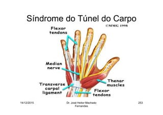 14/12/2015 Dr. José Heitor Machado
Fernandes
253
Síndrome do Túnel do Carpo
 