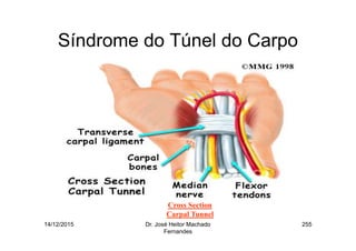 14/12/2015 Dr. José Heitor Machado
Fernandes
255
Síndrome do Túnel do Carpo
Cross Section
Carpal Tunnel
 