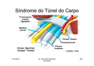 14/12/2015 Dr. José Heitor Machado
Fernandes
256
Síndrome do Túnel do Carpo
 