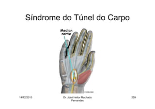 14/12/2015 Dr. José Heitor Machado
Fernandes
259
Síndrome do Túnel do Carpo
 