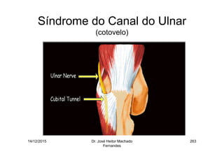 14/12/2015 Dr. José Heitor Machado
Fernandes
263
Síndrome do Canal do Ulnar
(cotovelo)
 