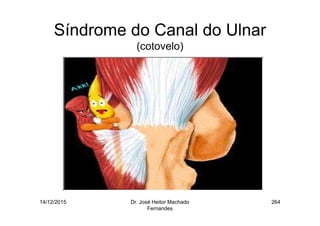 14/12/2015 Dr. José Heitor Machado
Fernandes
264
Síndrome do Canal do Ulnar
(cotovelo)
 