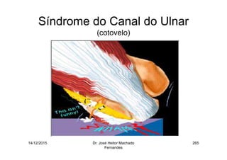 14/12/2015 Dr. José Heitor Machado
Fernandes
265
Síndrome do Canal do Ulnar
(cotovelo)
 