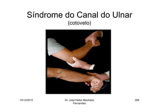 14/12/2015 Dr. José Heitor Machado
Fernandes
266
Síndrome do Canal do Ulnar
(cotovelo)
 