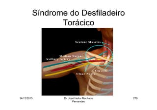 14/12/2015 Dr. José Heitor Machado
Fernandes
279
Síndrome do Desfiladeiro
Torácico
 