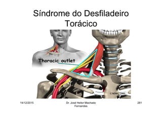 14/12/2015 Dr. José Heitor Machado
Fernandes
281
Síndrome do Desfiladeiro
Torácico
 