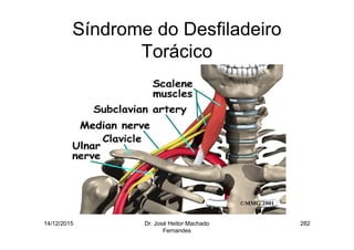 14/12/2015 Dr. José Heitor Machado
Fernandes
282
Síndrome do Desfiladeiro
Torácico
 