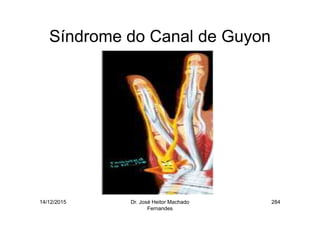 14/12/2015 Dr. José Heitor Machado
Fernandes
284
Síndrome do Canal de Guyon
 