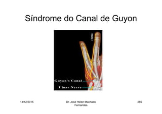 14/12/2015 Dr. José Heitor Machado
Fernandes
285
Síndrome do Canal de Guyon
 