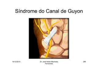 14/12/2015 Dr. José Heitor Machado
Fernandes
286
Síndrome do Canal de Guyon
 