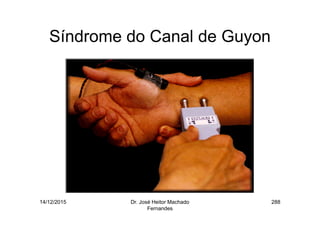 14/12/2015 Dr. José Heitor Machado
Fernandes
288
Síndrome do Canal de Guyon
 