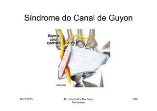 14/12/2015 Dr. José Heitor Machado
Fernandes
289
Síndrome do Canal de Guyon
 