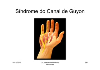 14/12/2015 Dr. José Heitor Machado
Fernandes
290
Síndrome do Canal de Guyon
 