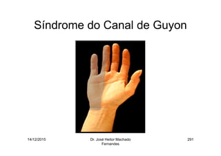 14/12/2015 Dr. José Heitor Machado
Fernandes
291
Síndrome do Canal de Guyon
 