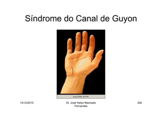 14/12/2015 Dr. José Heitor Machado
Fernandes
292
Síndrome do Canal de Guyon
 