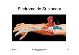 14/12/2015 Dr. José Heitor Machado
Fernandes
298
Sindrome do Supinador
 