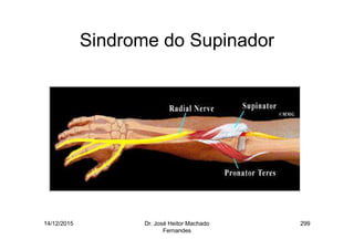 14/12/2015 Dr. José Heitor Machado
Fernandes
299
Sindrome do Supinador
 