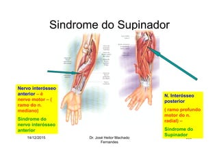 14/12/2015 Dr. José Heitor Machado
Fernandes
300
Sindrome do Supinador
N. Interósseo
posterior
( ramo profundo
motor do n.
radial) –
Síndrome do
Supinador
Nervo interósseo
anterior – é
nervo motor – (
ramo do n.
mediano)
Síndrome do
nervo interósseo
anterior
 