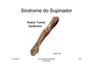 14/12/2015 Dr. José Heitor Machado
Fernandes
301
Sindrome do Supinador
 