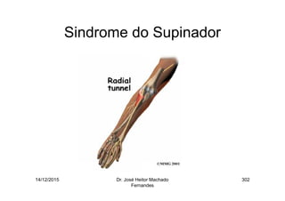 14/12/2015 Dr. José Heitor Machado
Fernandes
302
Sindrome do Supinador
 