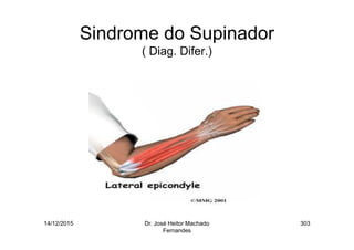 14/12/2015 Dr. José Heitor Machado
Fernandes
303
Sindrome do Supinador
( Diag. Difer.)
 