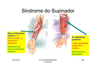 14/12/2015 Dr. José Heitor Machado
Fernandes
306
Sindrome do Supinador
N. Interósseo
posterior
( ramo profundo
motor do n.
radial) –
Síndrome do
Supinador
Nervo interósseo
anterior – é
nervo motor – (
ramo do n.
mediano)
Síndrome do
nervo interósseo
anterior
 