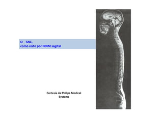 O SNC,
como visto por IRNM sagital
Cortesia da Philips Medical
Systems
 