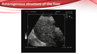 Heterogenous structure of the liver
 
