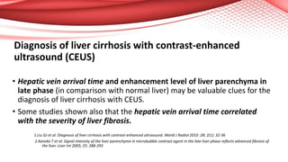 Diagnosis of liver cirrhosis with contrast-enhanced
ultrasound (CEUS)
• Hepatic vein arrival time and enhancement level of liver parenchyma in
late phase (in comparison with normal liver) may be valuable clues for the
diagnosis of liver cirrhosis with CEUS.
• Some studies shown also that the hepatic vein arrival time correlated
with the severity of liver fibrosis.
1.Liu GJ et al: Diagnosis of liver cirrhosis with contrast-enhanced ultrasound. World J Radiol 2010 :28; 2(1): 32-36
2.Kaneko T et al: Signal intensity of the liver parenchyma in microbubble contrast agent in the late liver phase reflects advanced fibrosis of
the liver. Liver Int 2005; 25: 288-293
 