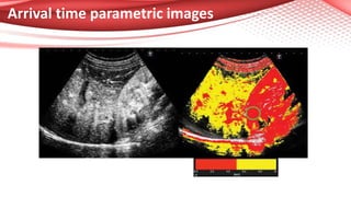 Arrival time parametric images
 
