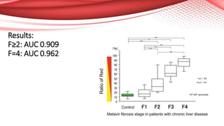 Results:
F≥2: AUC 0.909
F=4: AUC 0.962
 
