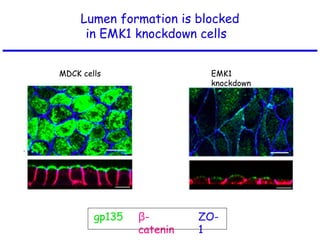 gp135
Lumen formation is blocked
in EMK1 knockdown cells
β-
catenin
ZO-
1
MDCK cells EMK1
knockdown
 