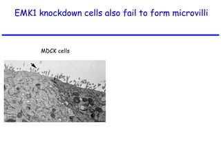 EMK1 knockdown cells also fail to form microvilli
MDCK cells EMK1
knockdown
 