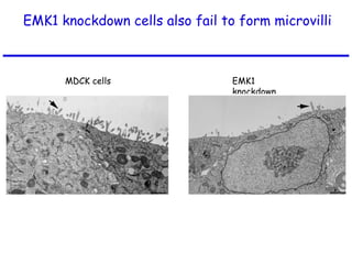 EMK1 knockdown cells also fail to form microvilli
MDCK cells EMK1
knockdown
 