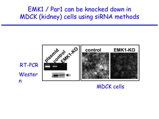RT-PCR
Wester
n
MDCK cells
EMK1 / Par1 can be knocked down in
MDCK (kidney) cells using siRNA methods
 