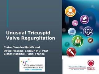Unusual Tricuspid
Valve Regurgitation
Claire Cimadevilla MD and
David Messika-Zeitoun MD, PhD
Bichat Hospital, Paris, France

 