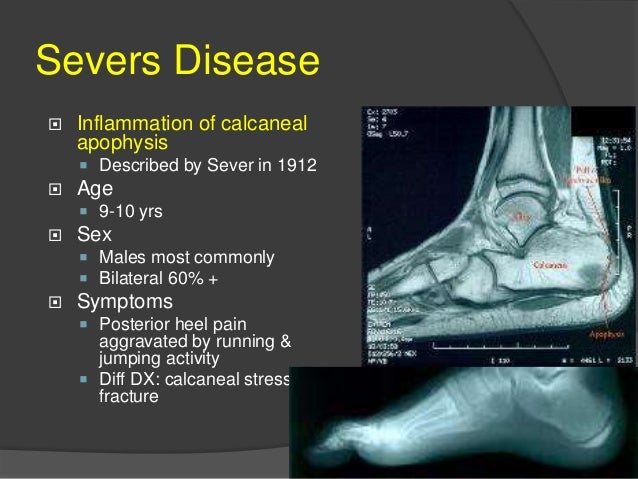 Injuries Unique to the Adolescent Athlete - Westchester Health Orthop…