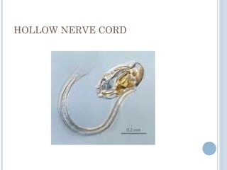HOLLOW NERVE CORD