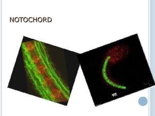 NOTOCHORDNOTOCHORD
