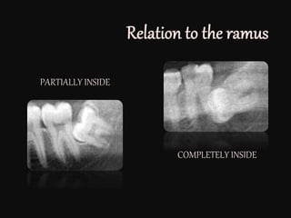 PARTIALLY INSIDE
COMPLETELY INSIDE
 