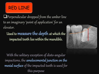 RED LINE
Perpendicular dropped from the amber line
to an imaginary ‘point of application’ for an
elevator.
Used to measure the depth at which the
impacted tooth lies within the mandible.
With the solitary exception of disto-angular
impactions, the amelocemental junction on the
mesial surface of the impacted tooth is used for
this purpose
 