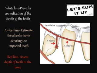White line-Provides
an indication of the
depth of the tooth
Amber line- Estimate
the alveolar bone
covering the
impacted tooth
Red line- Assess
depth of tooth in the
bone
 