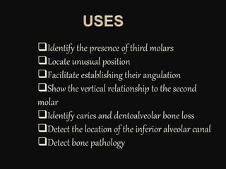 Identify the presence of third molars
Locate unusual position
Facilitate establishing their angulation
Show the vertical relationship to the second
molar
Identify caries and dentoalveolar bone loss
Detect the location of the inferior alveolar canal
Detect bone pathology
 