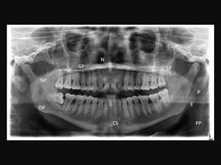 N
SP
P
PP
NP
E
OP
E
GP
CS
 