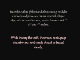 Trace the outline of the mandible including condylar
and coronoid processes, ramus, external oblique
ridge, inferior alveolar canal, mental foramen and 1st,
2nd and 3rd molars.
While tracing the teeth, the crown, roots, pulp
chamber and root canals should be traced
clearly.
 