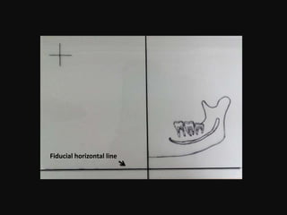 Fiducial horizontal line
 