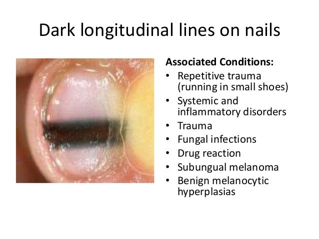A Pictoral Ddx For Nail Health
